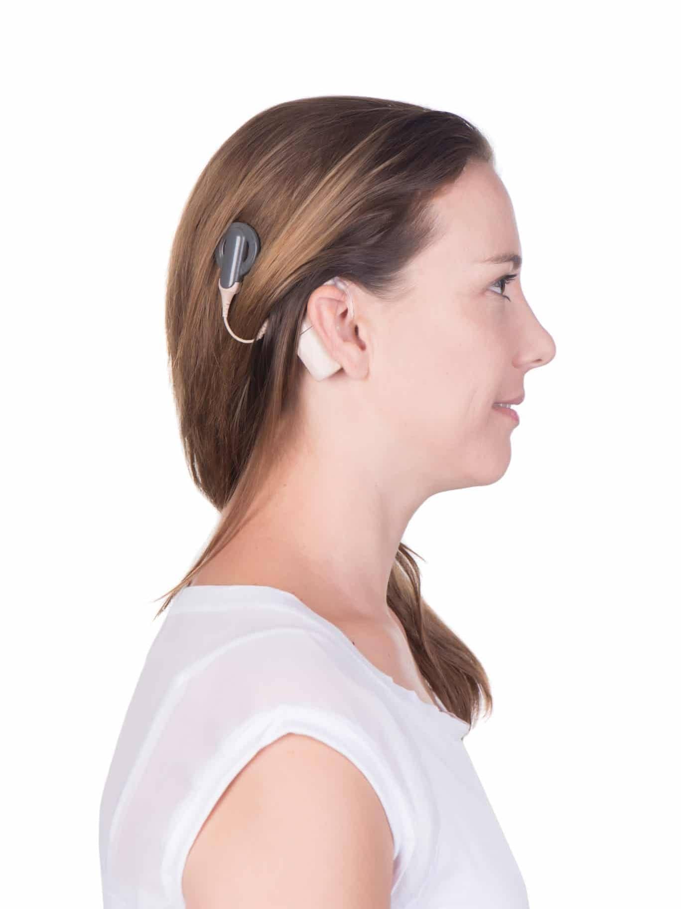 Implantable Hearing Aids Cochlear Implants Woman with hearing loss benefiting from implantable hearing aid
